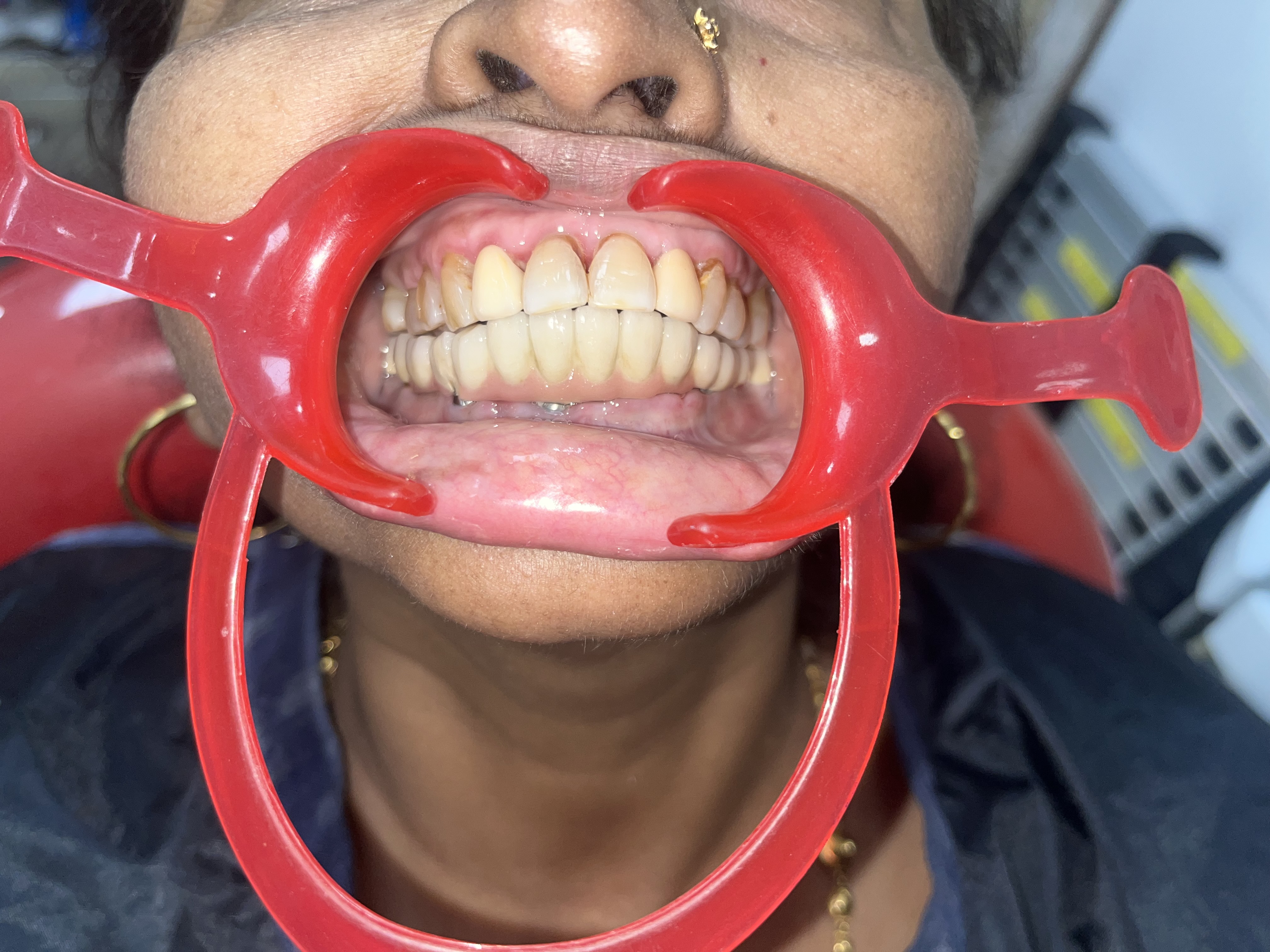 Dental Success 1