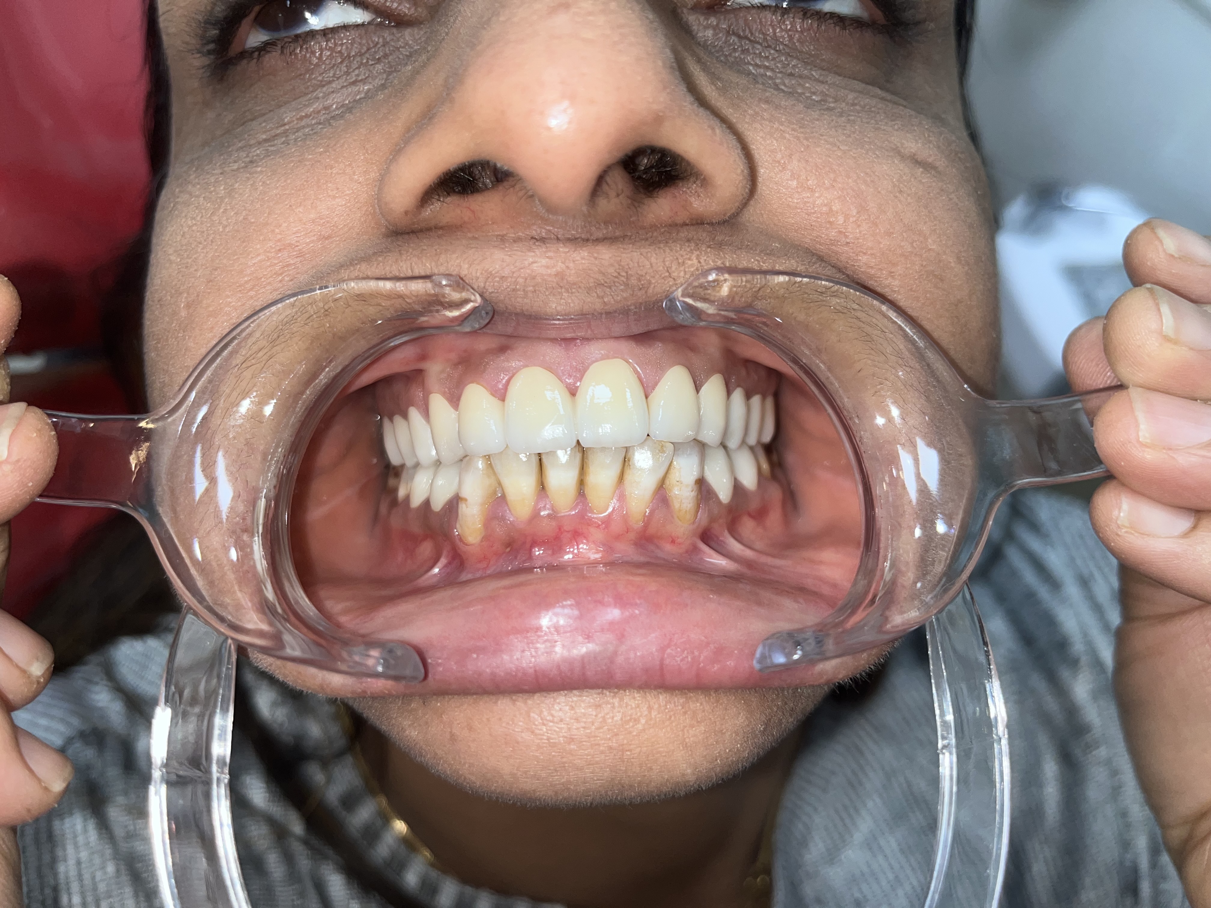 Dental Success 3